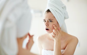 santé au quotidien acné